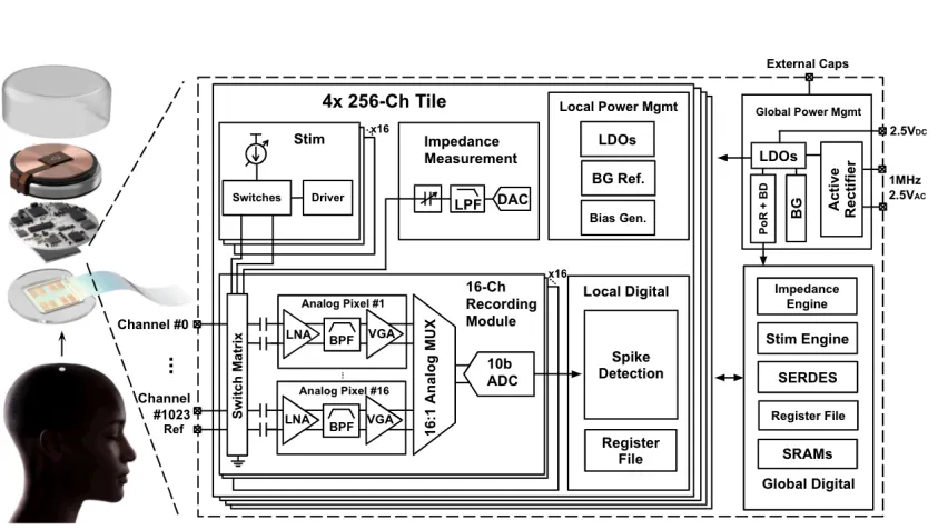 Visual breakdown of how Neuralink’s brain chip works
